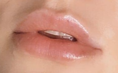 Juicy Lips by Artismed – autorska metoda powiększania ust